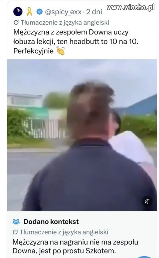 Mężczyzna nie ma Zespołu Downa