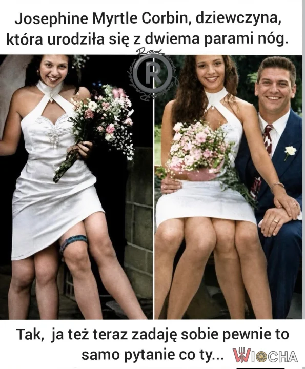 Kto ma lepsze nogi?