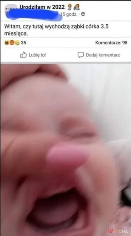 Czy tu wychodzą ząbki?