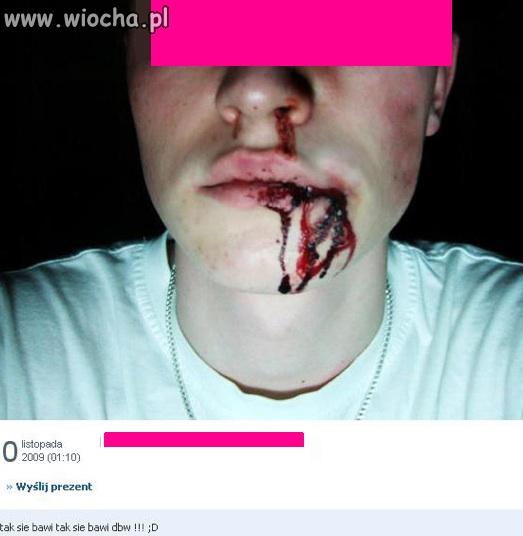 Tak wygląda totalny brak kory mózgowej