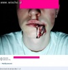 Tak wygląda totalny brak kory mózgowej