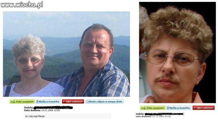Depilacja - bywa konieczna.