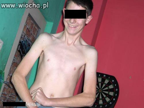 Napinka musi być 