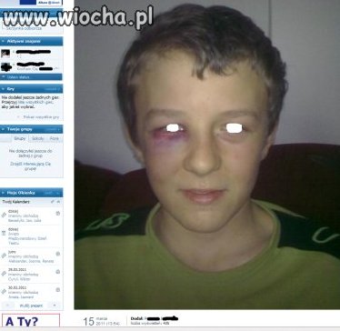 ''mała pizdeczka po wypadku''