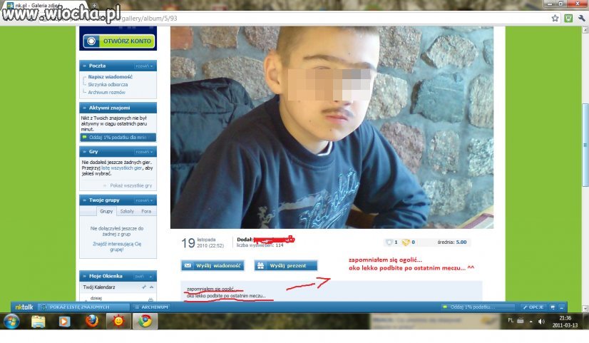 Zapomniał się ogolić ^^,aa i oko podbite po meczu