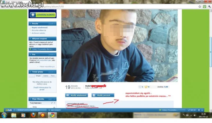 Zapomniał się ogolić ^^,aa i oko podbite po meczu