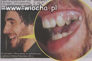 Zęby Maseraka