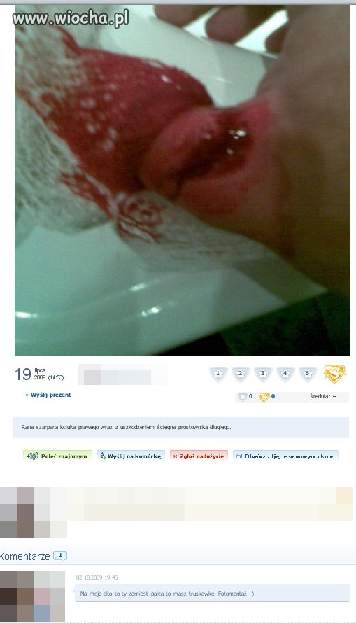 "Czy moje zdjęcie ogląda jakiś lekarz?"