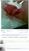 "Czy moje zdjęcie ogląda jakiś lekarz?"