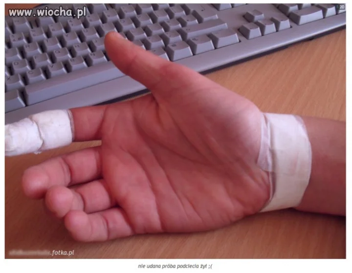 Nieudana próba podcięcia sobie żył ;(