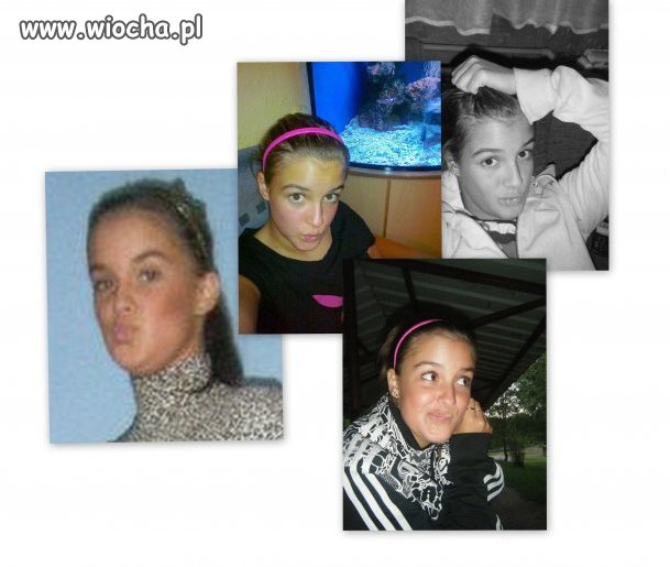 Paraliż twarzy!