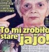 To mi zrobiło stare jajo 