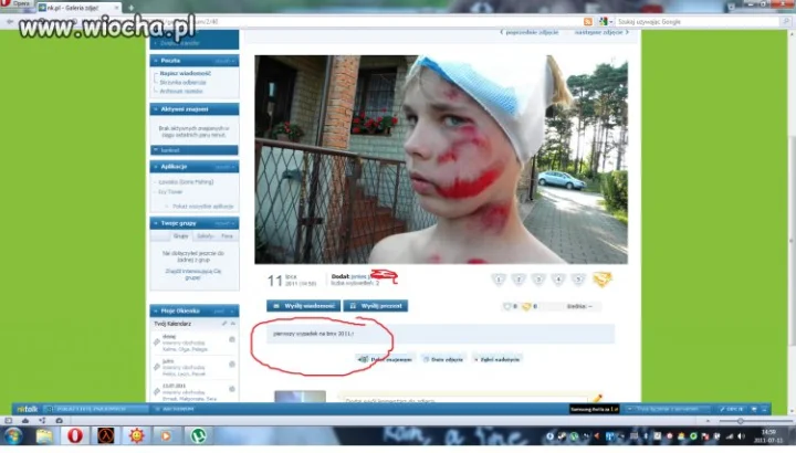Opis pod zdj: Pierwszy wypadek na bmx 2011r