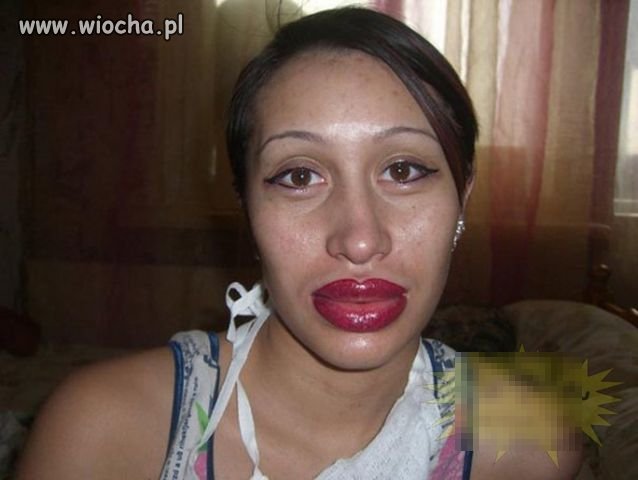 Kto chce buzi?
