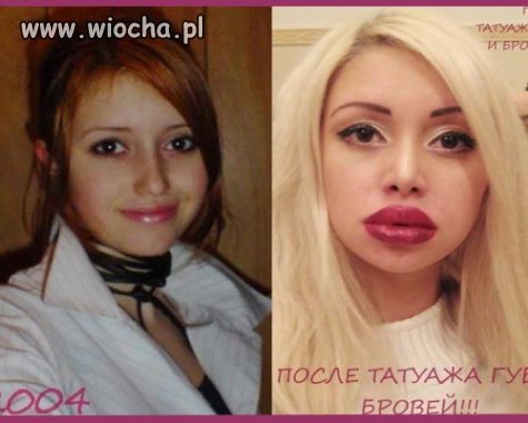 Operacja Plastyczna