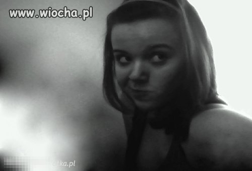 Krzywica twarzy.