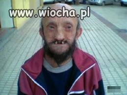 Uraz do dentysty?