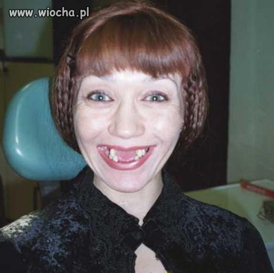 Nie no, ząbki eleganckie... 