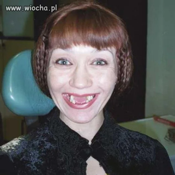 Nie no, ząbki eleganckie... 