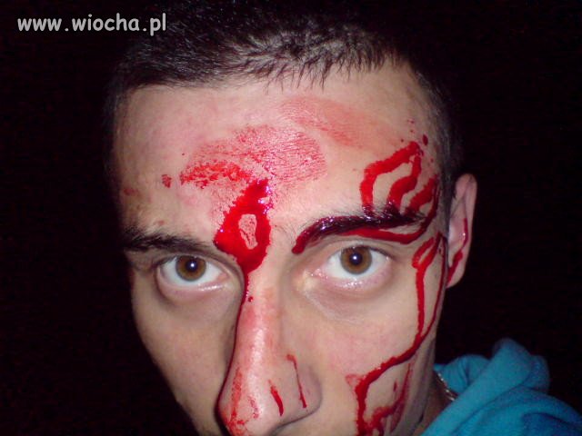 Musiał się gdzieś pochwalić jak mu obili. Tylko po co?