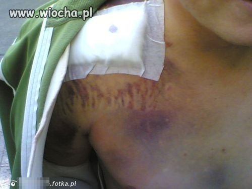 Trzeba sie pochwalić, że
