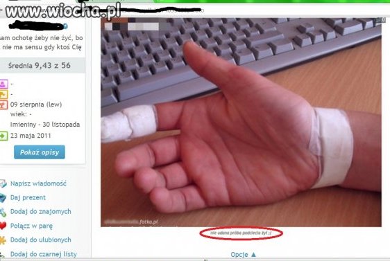 Opis: nieudana próba podcięcia sobie żył...