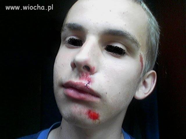 Następny który pochwalił się ze dostał 