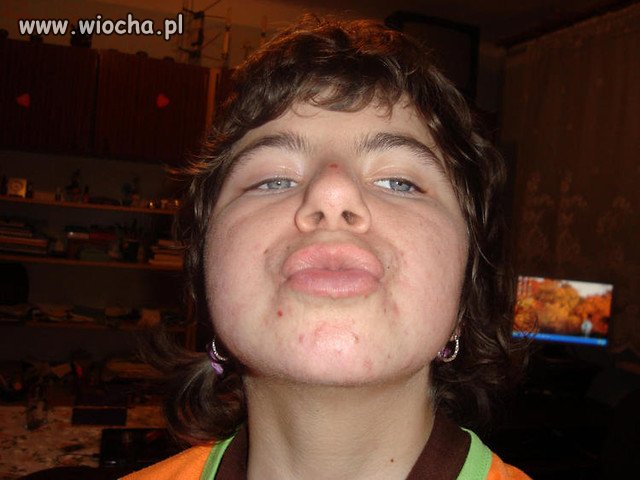 Buziol