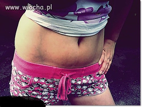 Teraz lans na brzuch??...