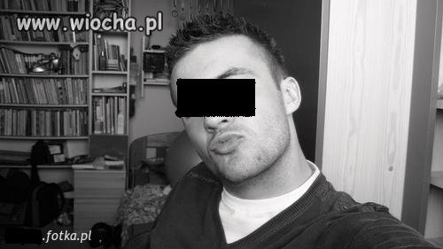Dopadł go paraliż twarzy, 