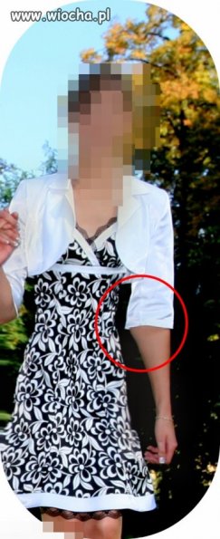 Mistrzyni photoscape i jej zdeformowana ręka