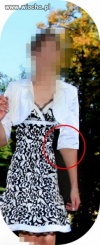 Mistrzyni photoscape i jej zdeformowana ręka