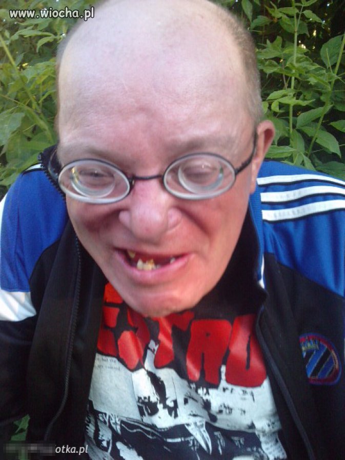 Jest dres Adidasa...