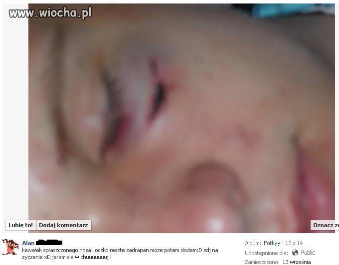 A takie tam, zdjęcie po pobiciu