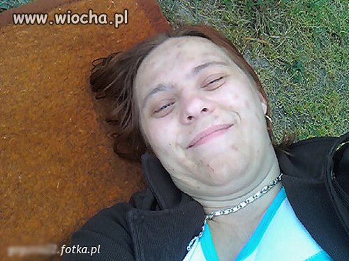 Co jej się z twarzą stało