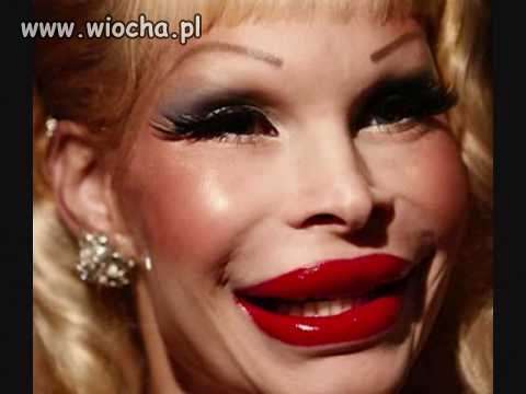 Operacja plastyczna 