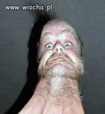 To sie nazywa szyja;p
