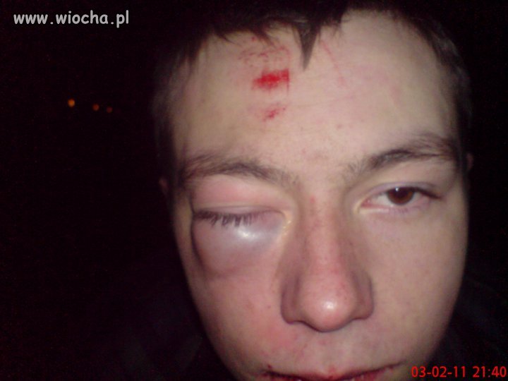 Podpis pod zdjeciem:
