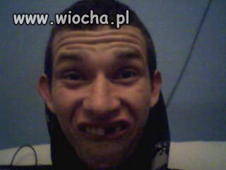 Przed wizytą u dentysty