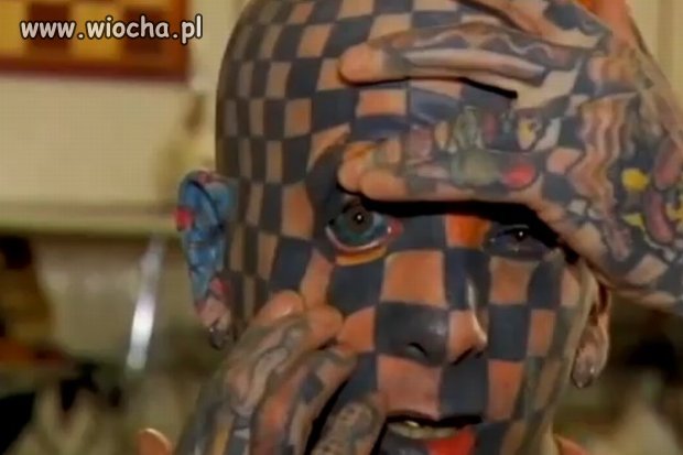 Czyżby zabrakło miejsca na ciele?