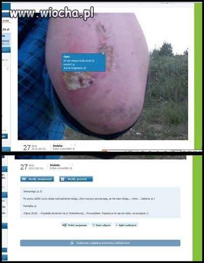 Facet chwali się, że mu krew leci ?