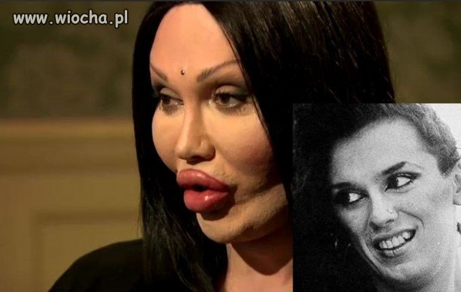Zemsta chirurga plastycznego