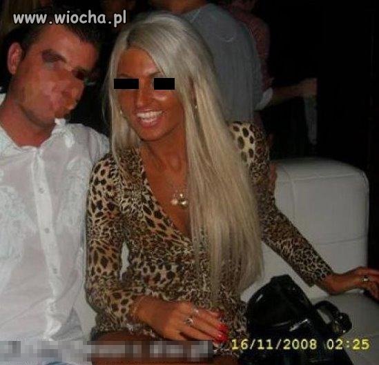 Plastik spalony na solarium