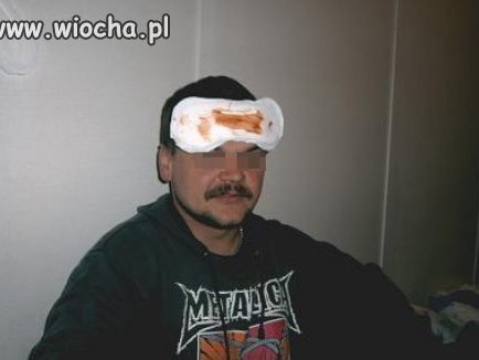 Sweet focia