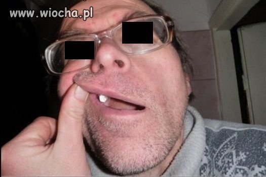 Ząbek to jest