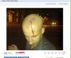 Rozwalili mi łeb, szybko rób zdjęcie 