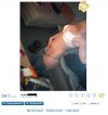 Buzi być nie musi