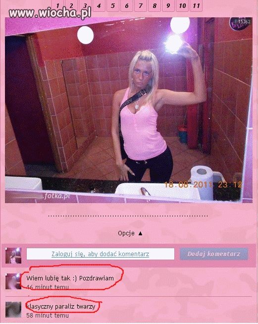 "klazyczny paraliż twarzy"