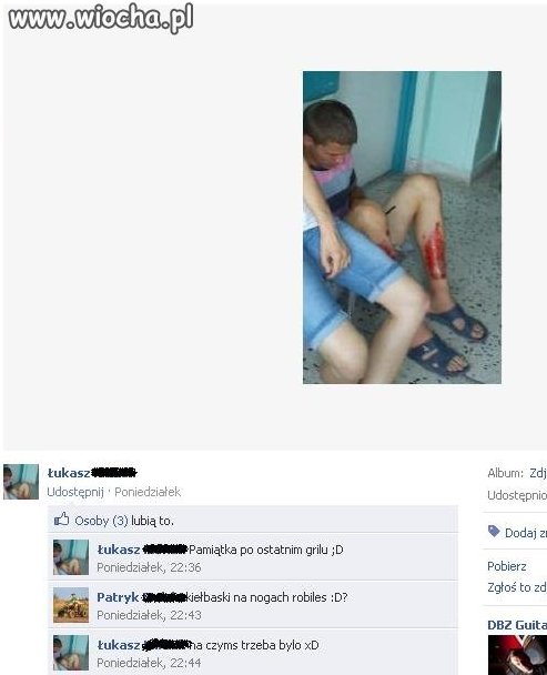 Rozwaliłem sobie noge muszę się tym pochwalić 