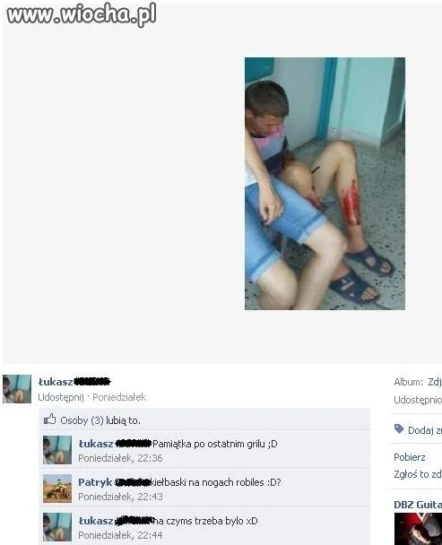 Rozwaliłem sobie noge muszę się tym pochwalić 